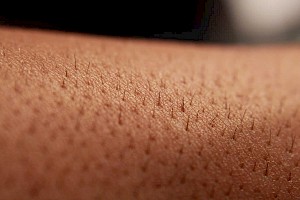 Dermatólogo / Dermatóloga